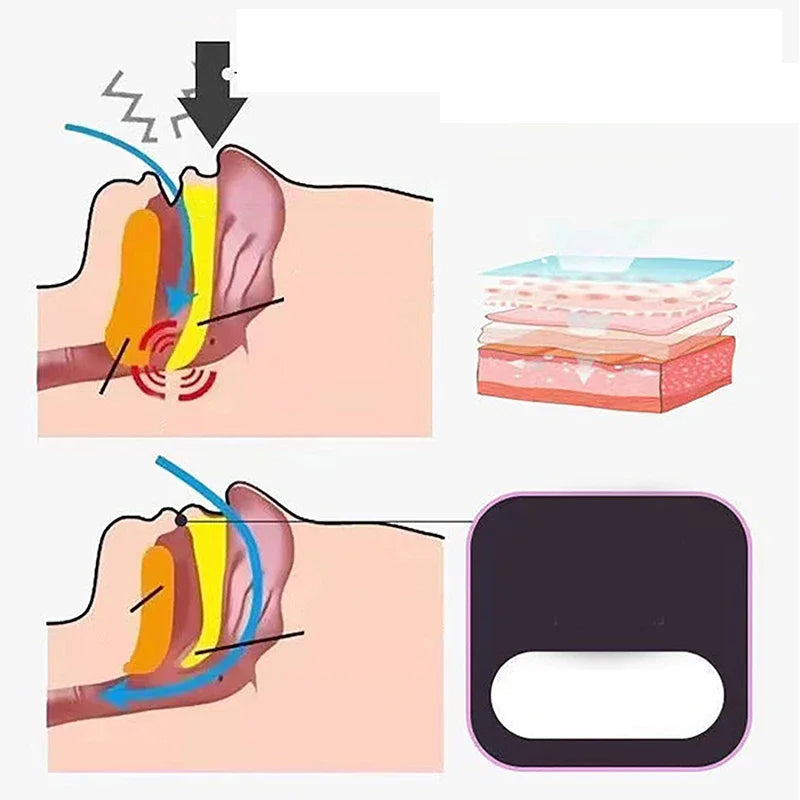 pain free removal anti snore stickers for adults